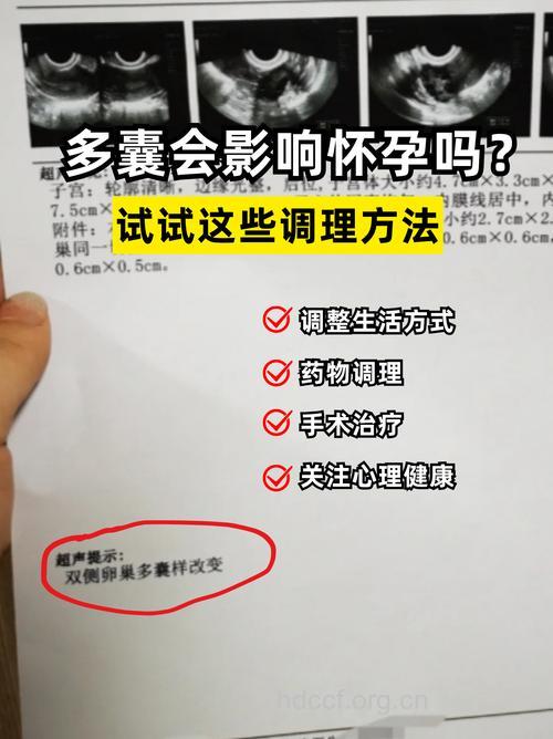 多囊卵巢会怀孕吗 积极治疗提高怀孕率