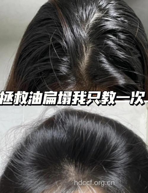 七种洗头方式让秀发越来越“伤”