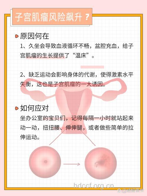 久坐不动也会导致子宫肌瘤吗