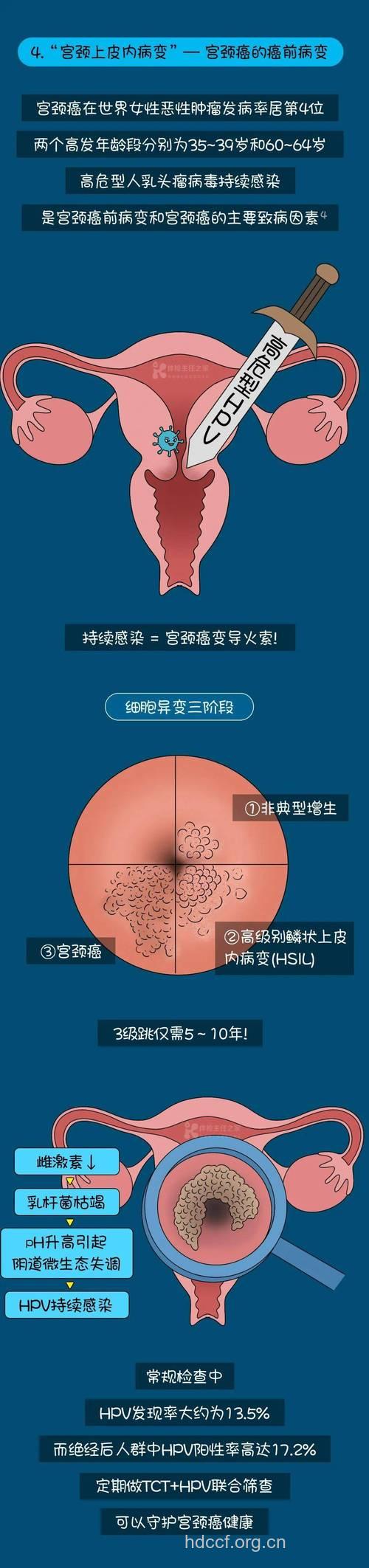 外阴白斑与外阴癌有什么关系