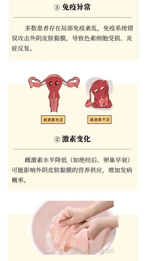 外阴白斑患者为什么会痒