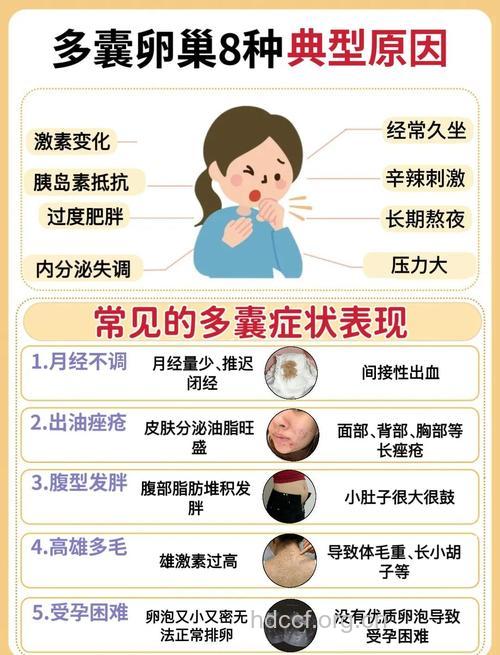 多囊卵巢综合征临床表现