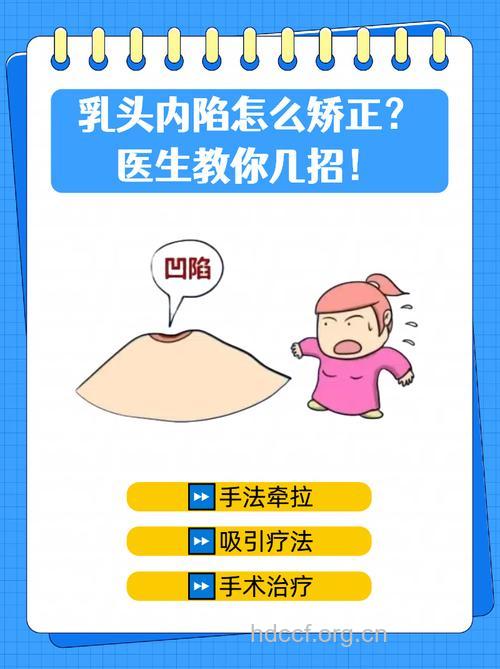 乳头内陷手术会有风险吗 女性不必过于担心