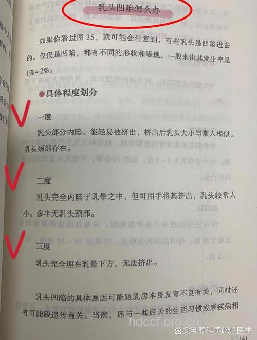 做乳头内陷矫正术需要多少钱 一般几千元