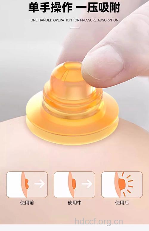 乳头内陷手术 乳头内陷支架法矫正好吗？