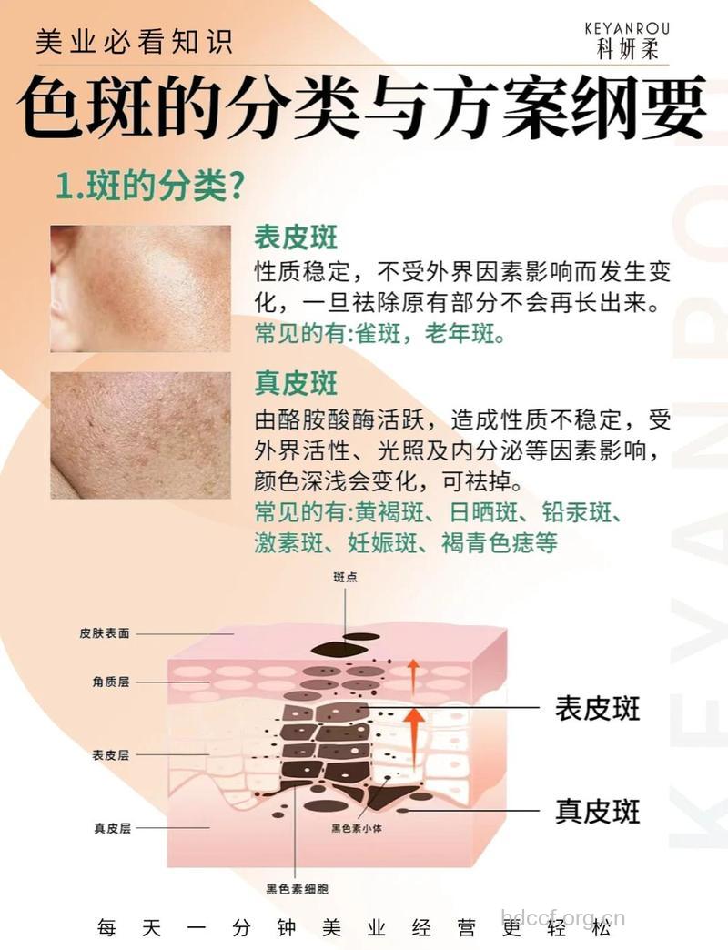 中年女人脸上长斑什么原因