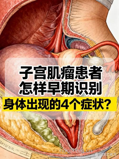 子宫肌瘤早期的症状