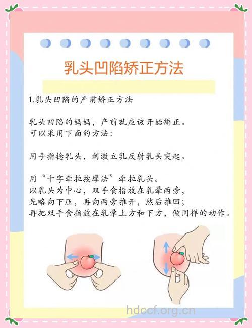 新妈妈乳头凹陷如何喂奶