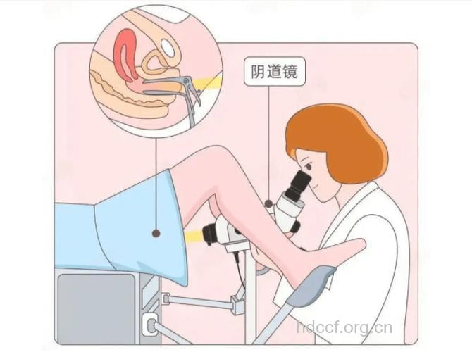 外阴白斑有哪些检查方法