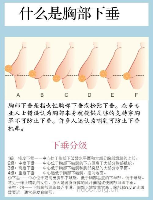 乳房下垂如何保健 想要健康乳房的来看看