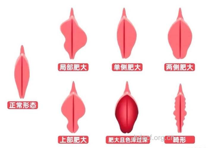 私处这五种情况要注意 女人怎么护理好