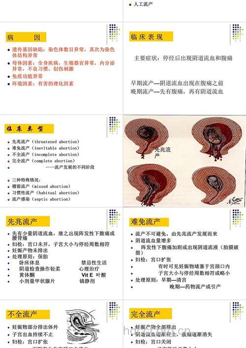 自然流产的类型有哪些