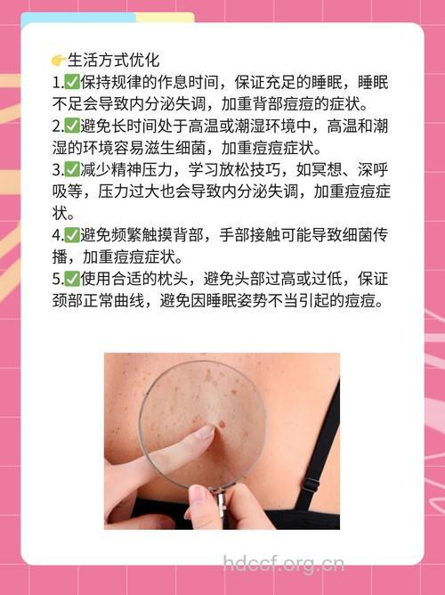 背部长痘痘是怎么回事 五个原因要注意