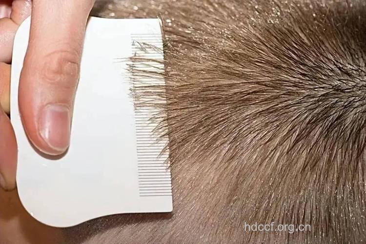 阴毛的作用是什么 女性阴毛可以剃掉吗