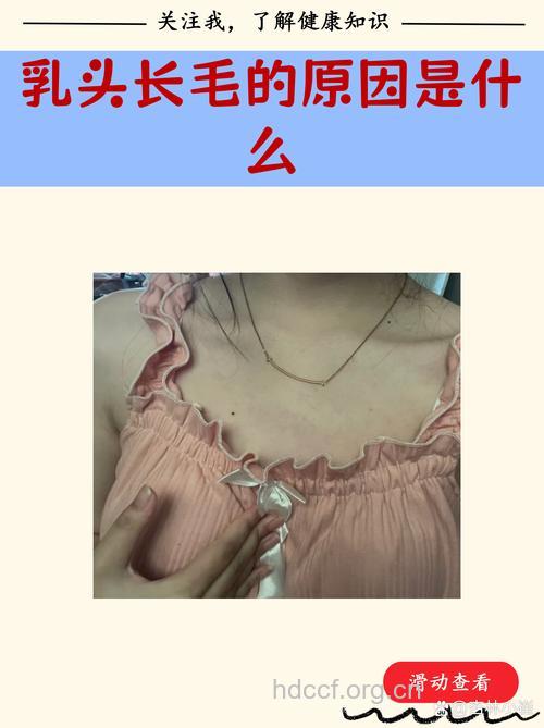 女性乳头长毛正常吗 乳头长毛是正常现象