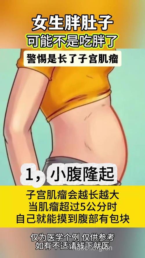 女性过胖会导致子宫肌瘤吗