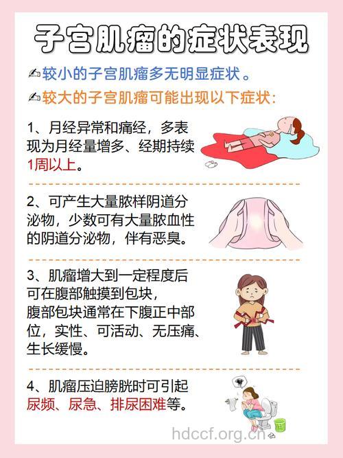 子宫肌瘤的腹部症状是什么呢