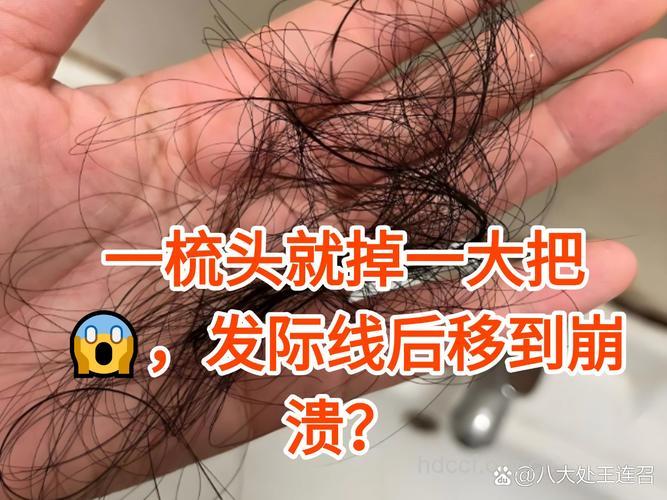 错误梳头易致脱发