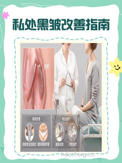 女人阴部变黑的原因是什么？该怎么办？