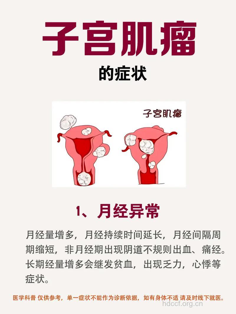 子宫肌瘤病的症状表现是什么