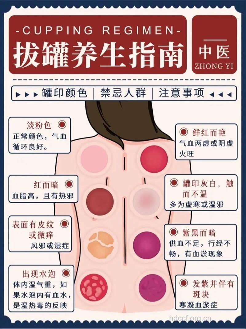 不可不知的拔罐注意事项