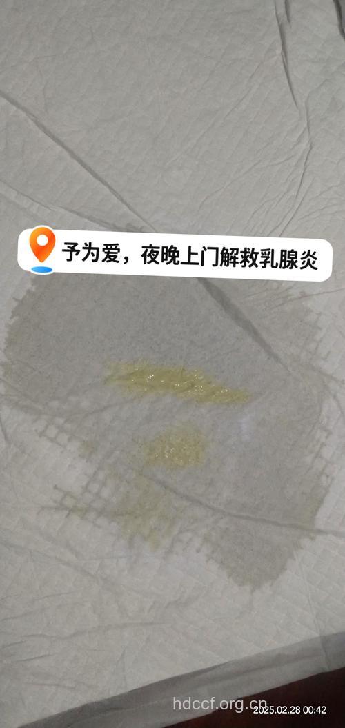 产后乳腺炎的症状 乳房胀痛体温升高