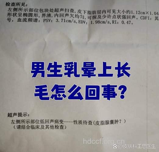 为什么乳头会长毛 第二性征成熟的表现