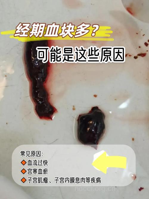 女性注意月经含有血块