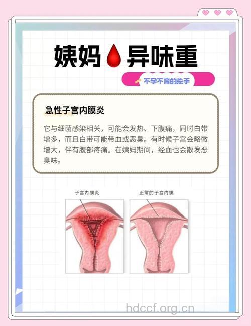 女性月经期间异味重的原因及解决方法