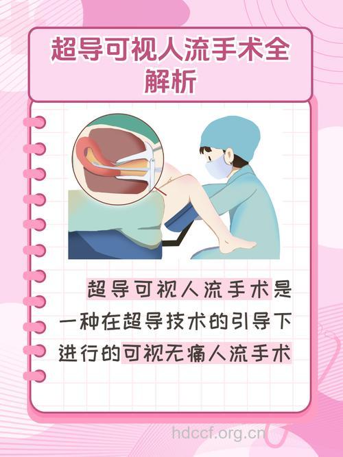 可视无痛人流手术有哪些优缺点