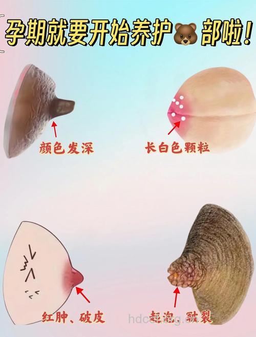 关于女性乳头乳晕问答全集