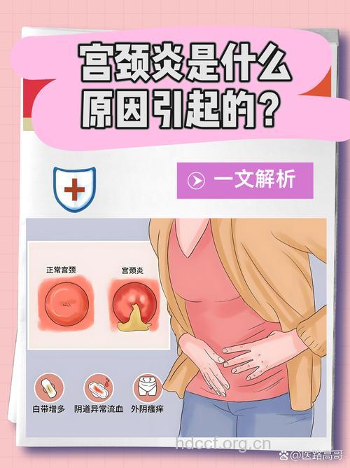 女人为什么会得宫颈炎 这三个是发病原因