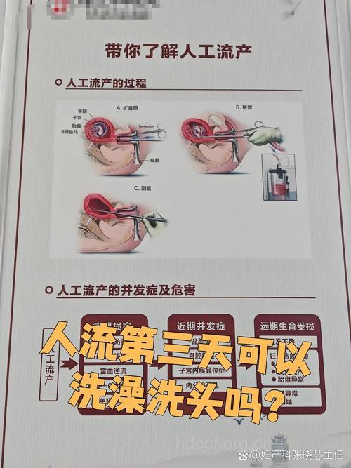 清宫手术后能洗头吗 这些事项要注意