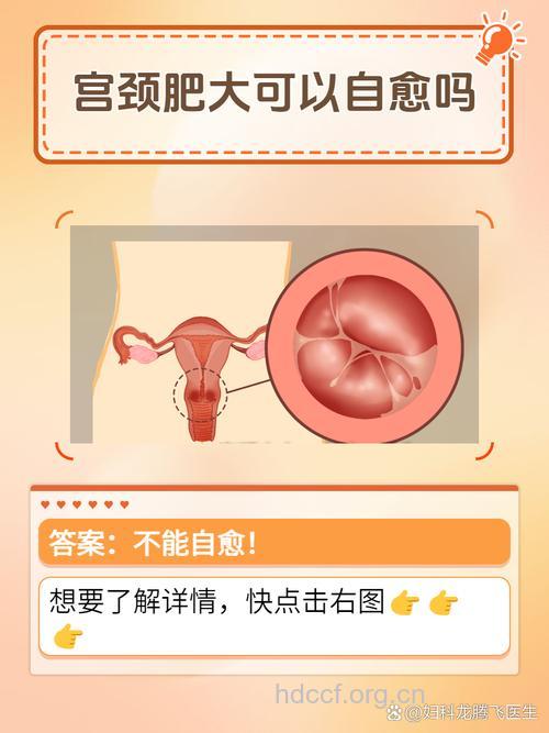 女性在家怎么鉴别宫颈肥大