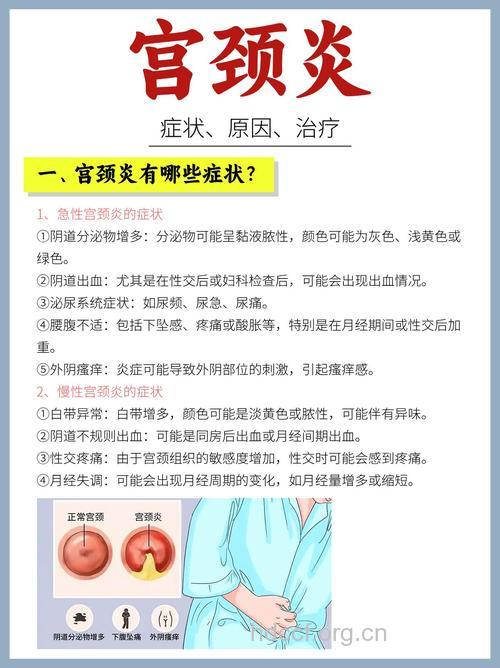 引发女性宫颈炎的原因有哪些