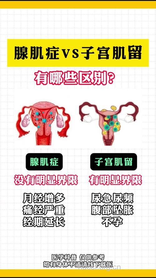 子宫肌瘤容易与哪些疾病混淆？