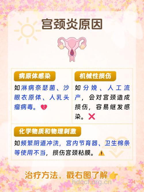 引起宫颈炎的原因是多种多样的