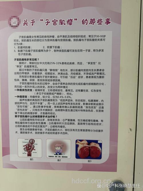 子宫肌瘤会出血吗 出血不止怎么办