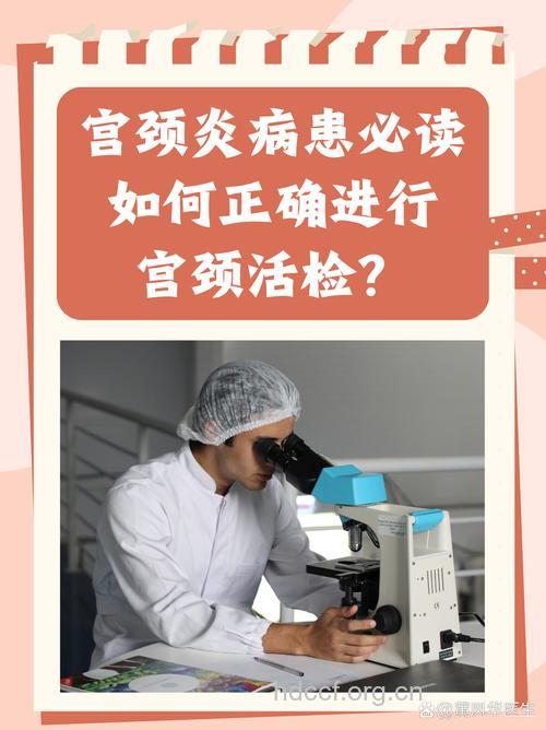 宫颈炎要做哪些检查