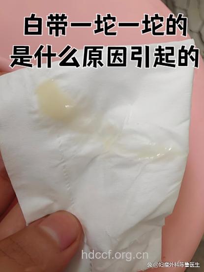 中度宫颈炎有哪些症状 白带异常月经量多
