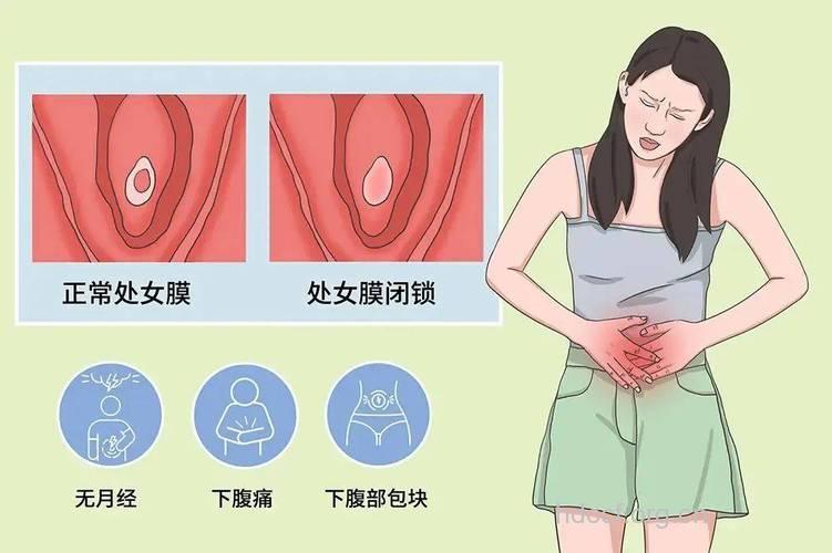 护理阴道需注意这两点 不懂护阴的女人要来看看