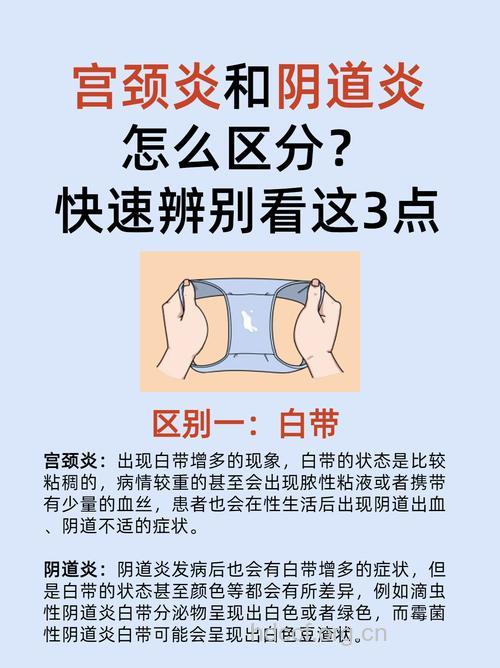 白带量多是宫颈炎的症状吗