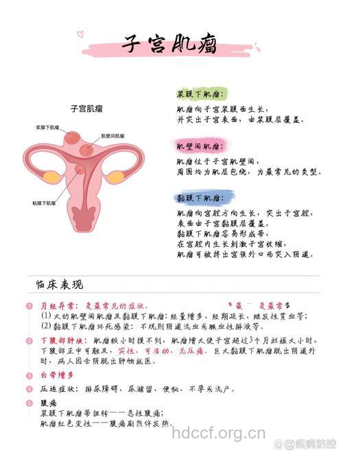 孕期子宫肌瘤的护理方法