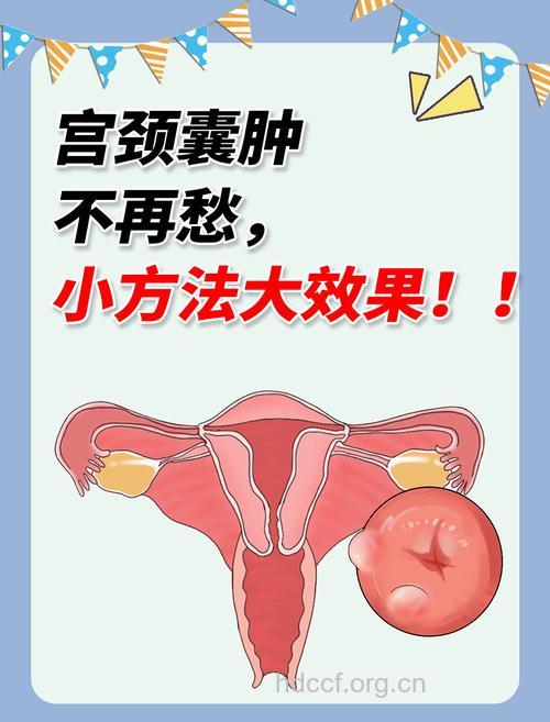 子宫囊肿有哪些治疗方法