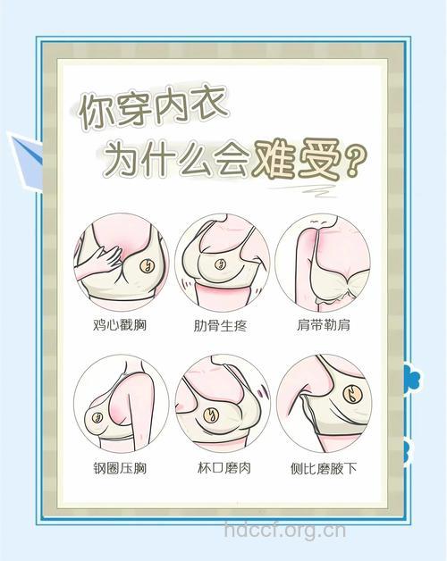 内衣不透气会引发乳腺炎
