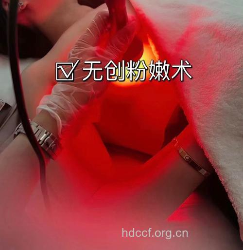 整形术造粉嫩乳晕 乳晕漂红的效果如何