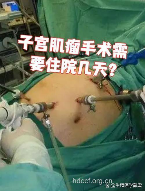 子宫肌瘤一定要手术吗