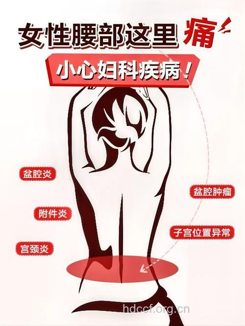 女性腰痛警惕妇科病