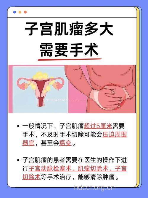 子宫肌瘤需要切除子宫吗