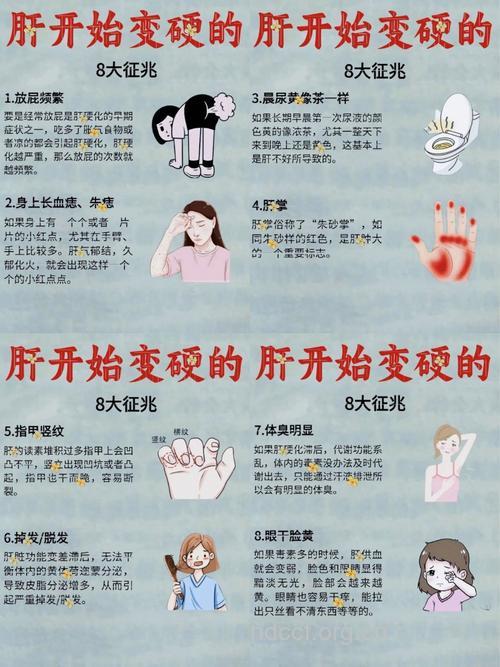 肝脏不好的症状有哪些 需养肝的8大信号